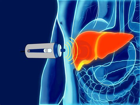 FibroScan .